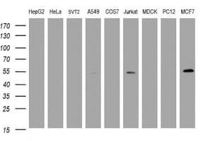 TAPBPL / TAPBPR Antibody (clone OTI2E11)