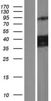 CCDC109B Protein (Over-Expression Lysate Myc-DDK (Flag))