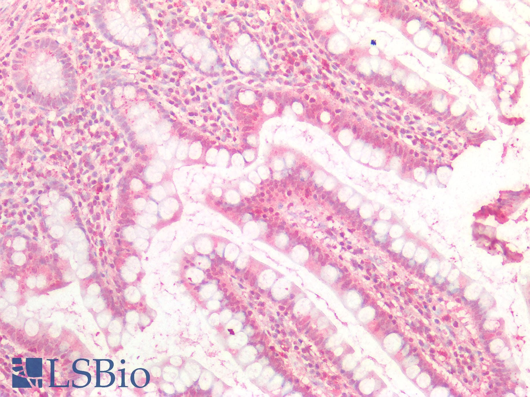 IHC-plus™ FOLR1 / Folate Receptor Alpha Antibody
