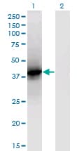 LCAT Antibody (clone 4A9)