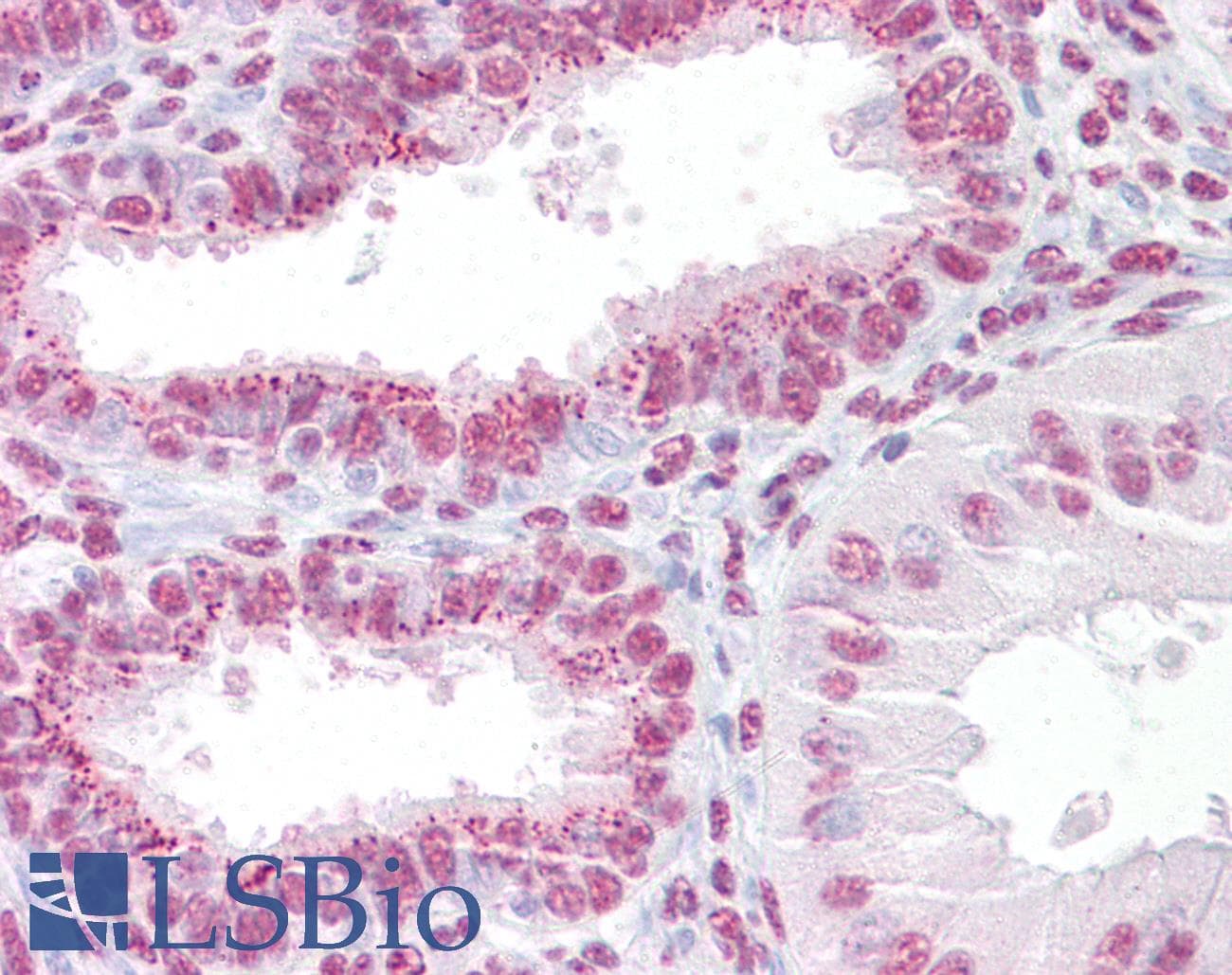 IHC-plus™ ANAPC11 / APC11 Antibody
