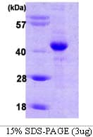 Human HIF1AN Protein (Recombinant)