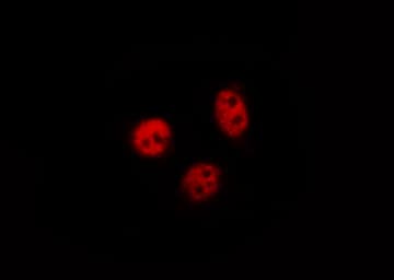 NFKB1 / NF-Kappa-B Antibody (phospho-Ser927)