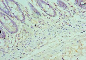 TFDP1 Antibody (aa1-290)