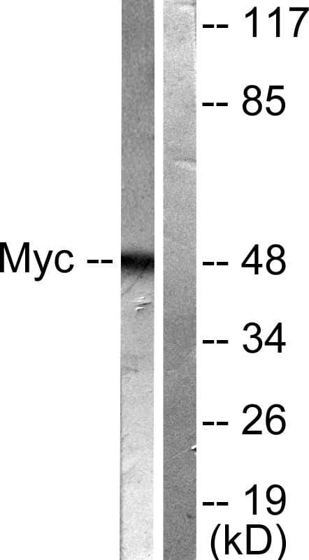 Polyclonal Rabbit anti-Human MYC / c-Myc Antibody (aa31-80, IHC, IF, WB)
