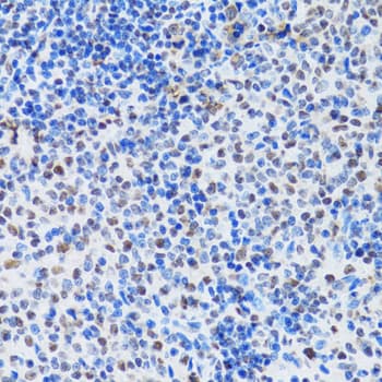 MTA3 Antibody