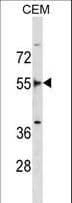 FRS2 Antibody (aa275-303)
