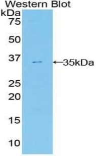 ENPP2 / Autotaxin Antibody (aa637-905)