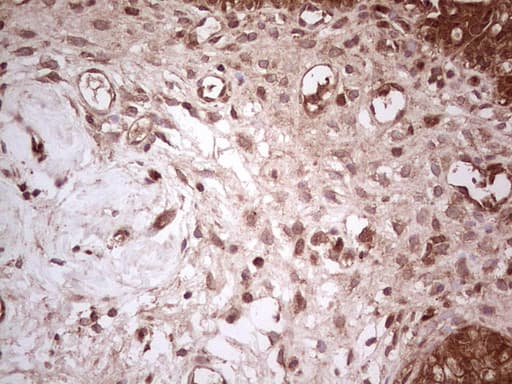 UBE2D2 / UBCH5B Antibody (clone OTI2C2)