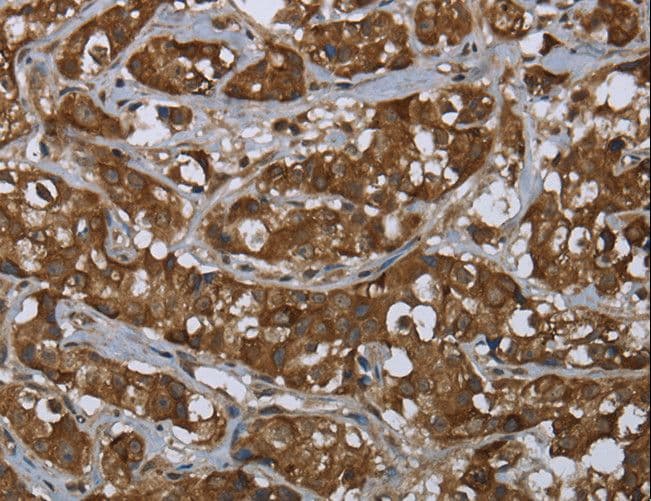 Polyclonal Rabbit anti-Human PIP / GCDFP-15 Antibody (IHC)