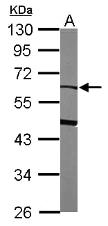 IHC-plus™ SERPINF2 / Alpha-2-Antiplasmin Antibody (aa188-453)