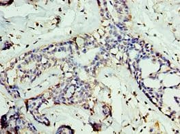 Polyclonal Rabbit anti-Human GAN Antibody (aa1-240, IHC)
