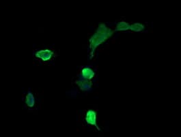 MAP2K3 / MEK3 / MKK3 Antibody (clone OTI2D7)