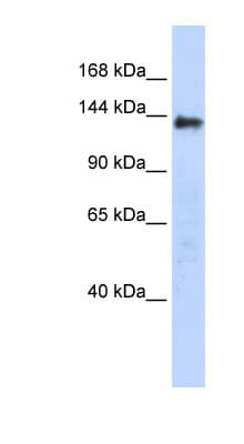 DENND2C Antibody (aa359-408)