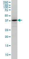 Monoclonal Mouse anti-Human TSTA3 / GDP-L-Fucose Synthase Antibody (clone 2B9, WB)