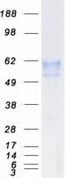 Human BACE1 / BACE Protein (Recombinant Myc-DDK (Flag))