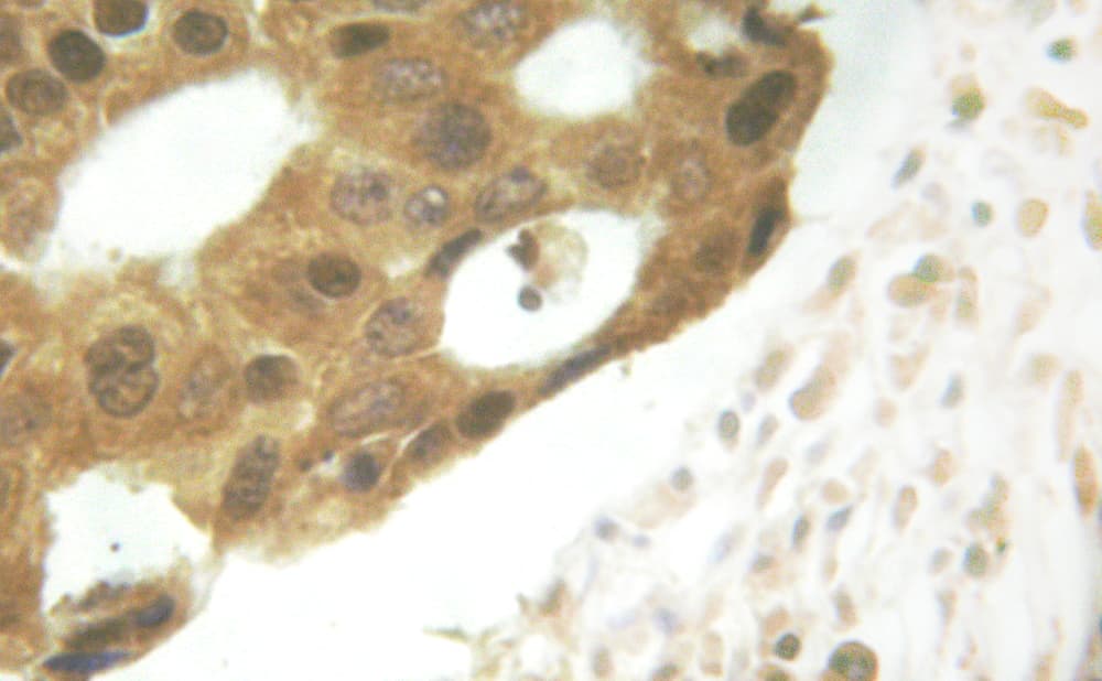 STAT5A Antibody (phospho-Ser725,pSer730)