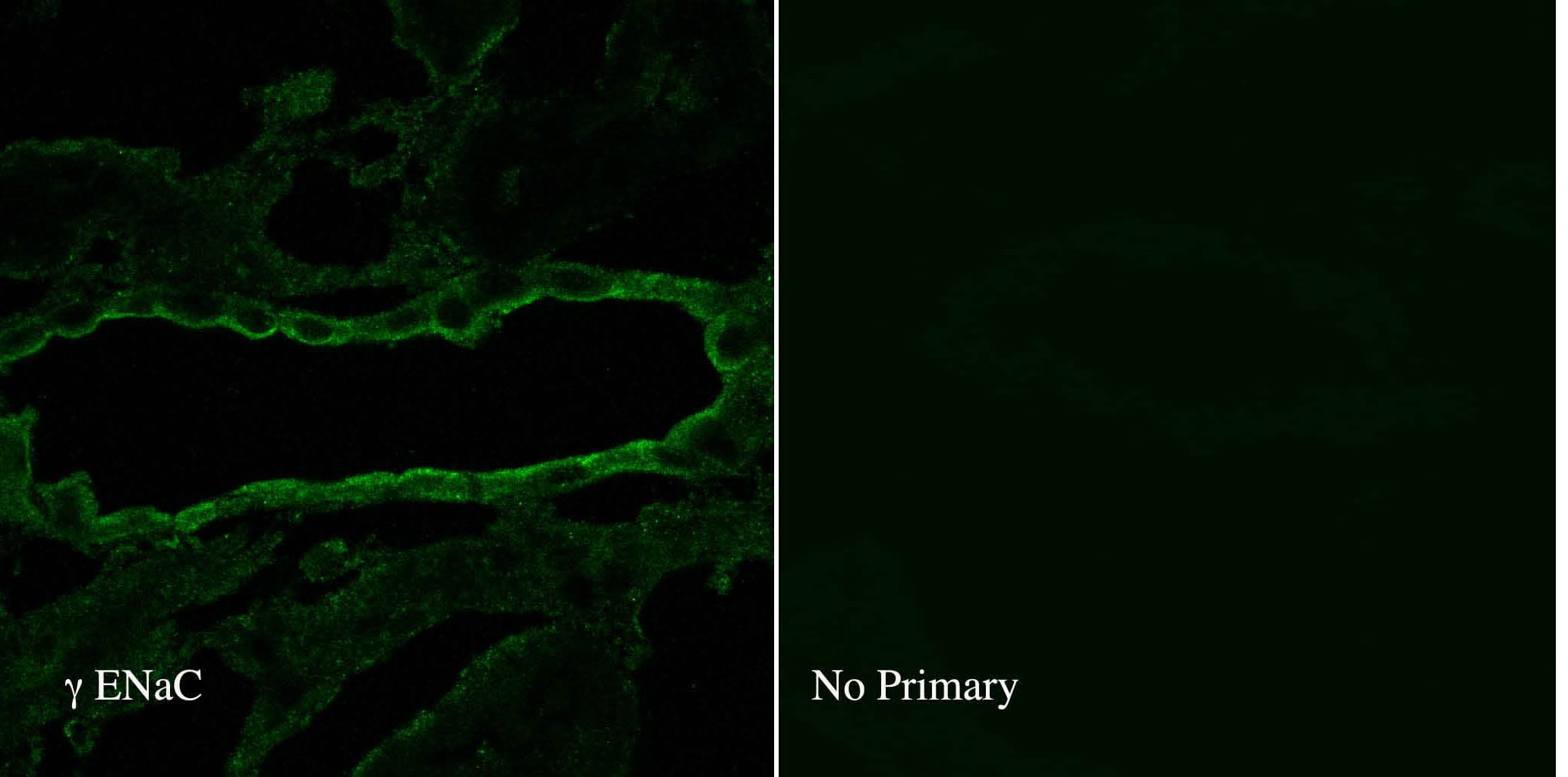 SCNN1G / ENaC Gamma Antibody