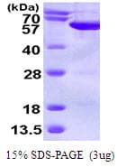 Human SEPT6 / Septin 6 Protein (Recombinant His)