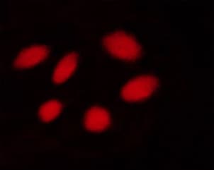Polyclonal Rabbit anti-Human STK11 / LKB1 Antibody (phospho-Ser428, IHC, IF, WB)