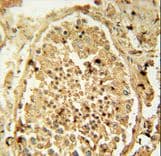 Polyclonal Rabbit anti-Human PDHA2 / PDH E1 Beta Antibody (aa287-314, IHC, WB)