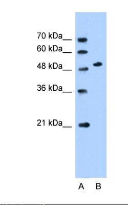 SLC30A1 / ZNT1 Antibody (aa281-330)