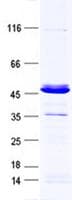 Human GCAP3 / GUCA1C Protein (Recombinant GST, N-terminus + His, C-terminus)