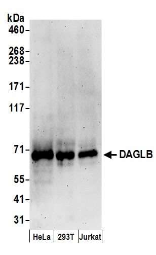 Polyclonal Rabbit anti-Human DAGLB Antibody (aa622-672, WB)