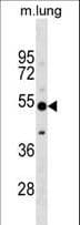 CALCRL / CGRP Receptor Antibody (aa340-367)