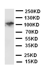 Polyclonal Rabbit anti-Human CSF1R / CD115 / FMS Antibody (aa955-972, WB)