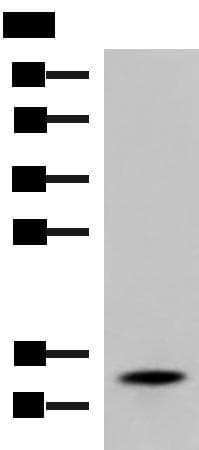 Polyclonal Rabbit anti-Human TTR / Transthyretin Antibody (IHC, WB)