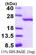 Human RBBP9 Protein (Recombinant His)
