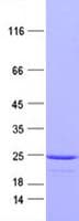 Human SYNC / SYNCOILIN Protein (Recombinant DDK,C-terminus)