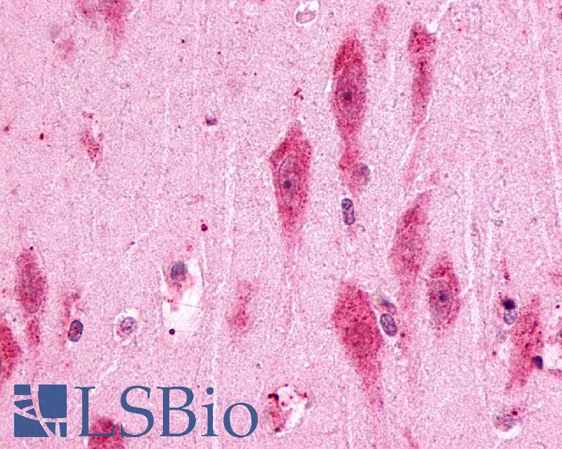 IHC-plus™ Polyclonal Rabbit anti-Human PTGER3 / EP3 Antibody (Cytoplasmic Domain, IHC)