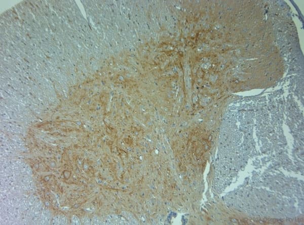Polyclonal Rabbit anti-Human ACAN / Aggrecan Antibody (aa200-250, IHC)