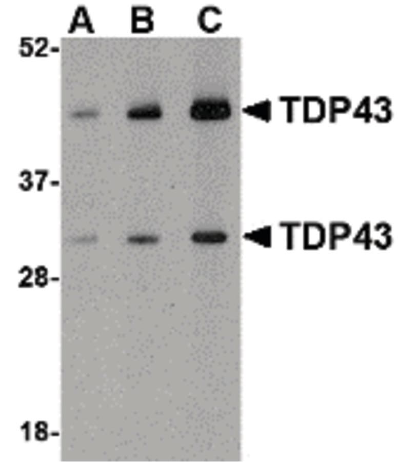 Polyclonal Rabbit anti-Human TDP-43 / TARDBP Antibody (IF, WB)
