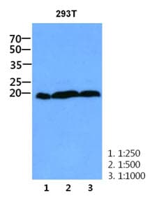 Monoclonal Mouse anti-Human CNBP / ZNF9 Antibody (clone 38F10, WB)