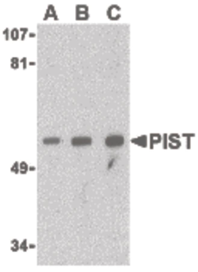 GOPC / PIST Antibody