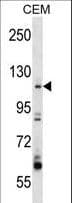 ARHGEF1 Antibody (aa164-192)