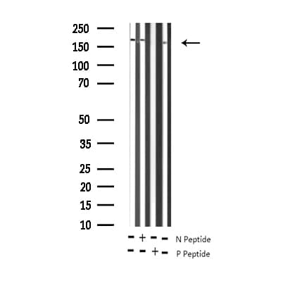 ERBB2 / HER2 Antibody (phospho-Tyr877)