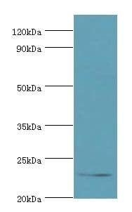 APOBEC3C Antibody (aa1-190)