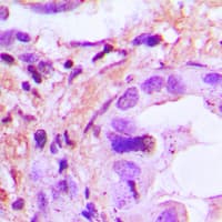 IL8 / Interleukin 8 Antibody (Internal)