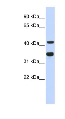 Polyclonal Rabbit anti-Human POLD2 Antibody (aa143-192, WB)
