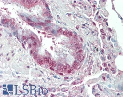 IHC-plus™ ARNT / HIF-1-Beta Antibody (aa575-625)