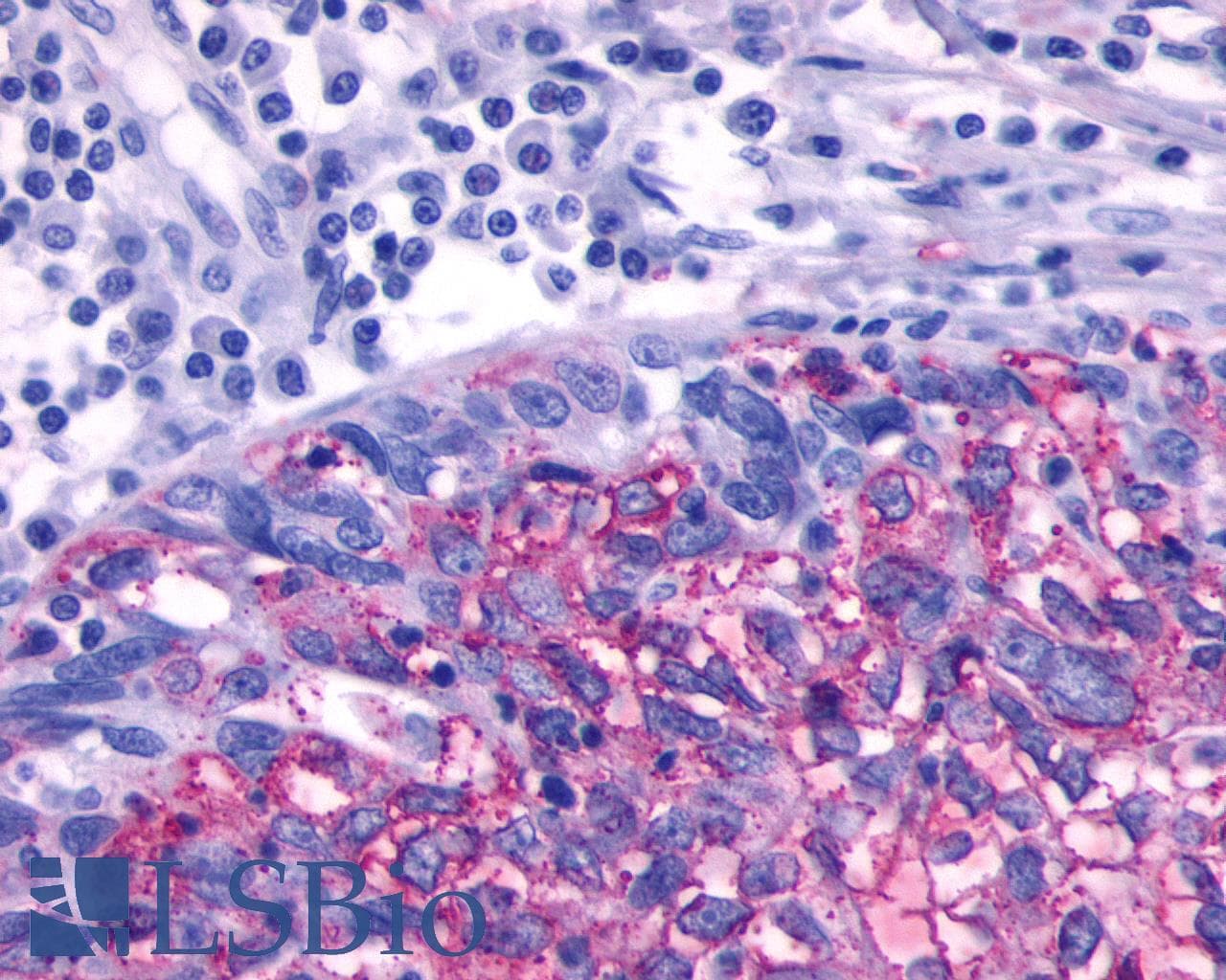 PathPlus™ ADRB3 Antibody (N-Terminus)
