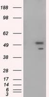 Monoclonal Mouse anti-Human p66 / SHC Antibody (clone OTI1D3, IF, WB)