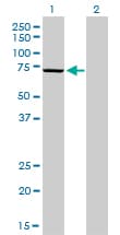 Monoclonal Mouse anti-Human MPP3 Antibody (clone 4D7, WB)