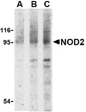 IHC-plus™ NOD2 / CARD15 Antibody