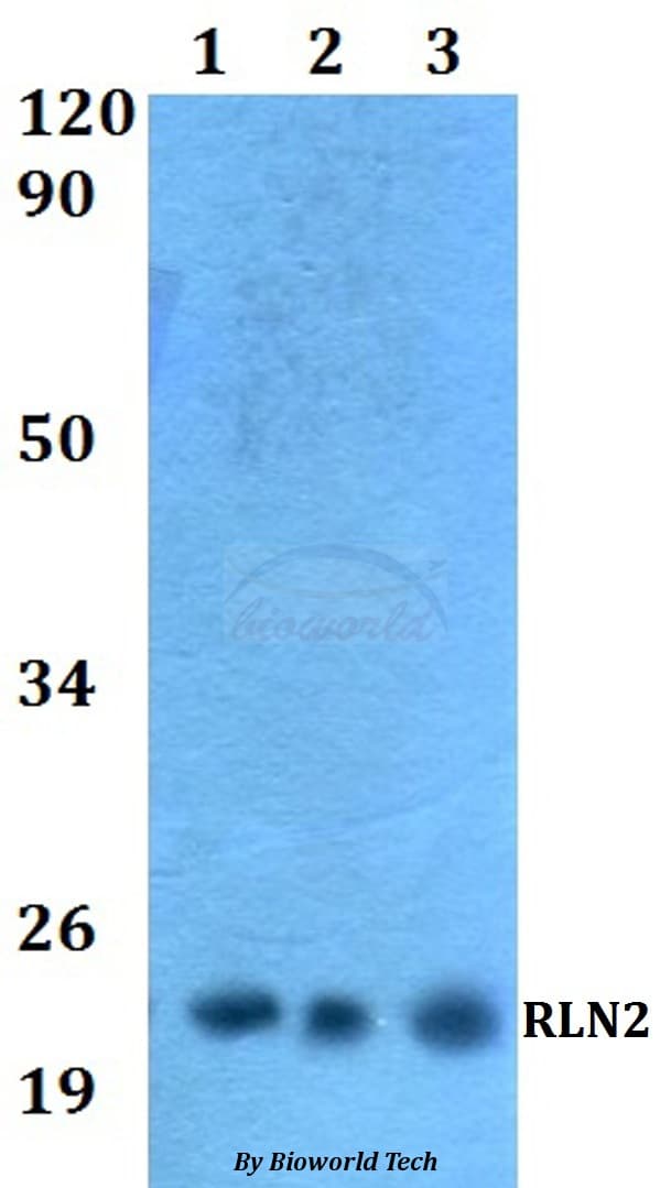 Polyclonal Rabbit anti-Human RLN2 / Relaxin 2 Antibody (WB)