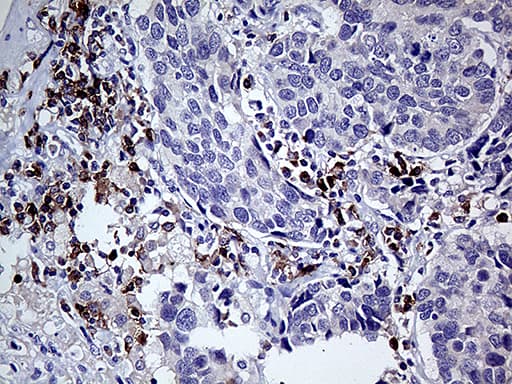 CD79B / CD79 Beta Antibody (clone OTI9H8)